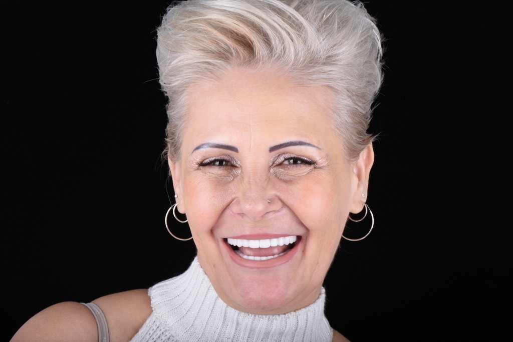 hollywood smile iskutva pacijenata - pacijentkinja Jovana Bleach 1 boja - cirkonijum krunice preko zubnih implanta - stomatološka ordinacija dr Lolin
